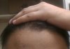 Front Hairline 2.jpg