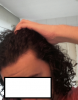 Hairline left.png