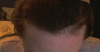 hairline.png
