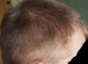right-side-dry.jpg