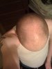 BALDING 2.jpg