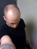 BALDING 6.jpg