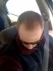 BALDING 2 1-2 MONTH.jpg