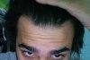 hairline.jpg