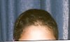 hairline age 10.jpg