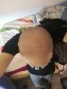 hair loss 4.jpg