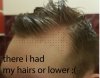 mybalding2.jpg