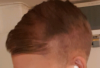 pic 2 side of head.PNG