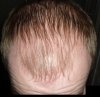 front-top-hairfoward-closeup.jpg