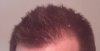 hairline.jpg