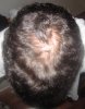 balding51210 001.jpg