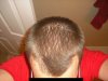 HairLossTalk.com 1.jpg