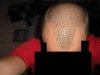 HairLossTalk.com-August Pic.jpg