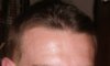 hairline2.jpg