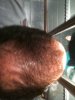 hairloss 2.jpg