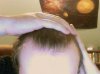 hairline3.jpg