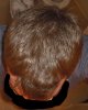 HairLossTalk.com-Updated Pic-1.jpg