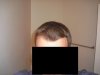 HairLossTalk.com-Update-Front.jpg