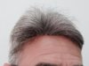 hairline.jpg