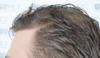 hairline 3.png