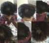 complete hair fall pictures.jpg