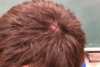hairwhorl1.jpg