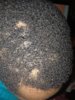 PATCHY HAIR WIH PAIN 2.jpg
