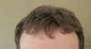 hairline.jpg