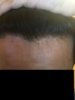 Hairline 3.JPG