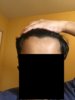 Hairline 4.JPG