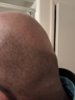 bald4.jpg