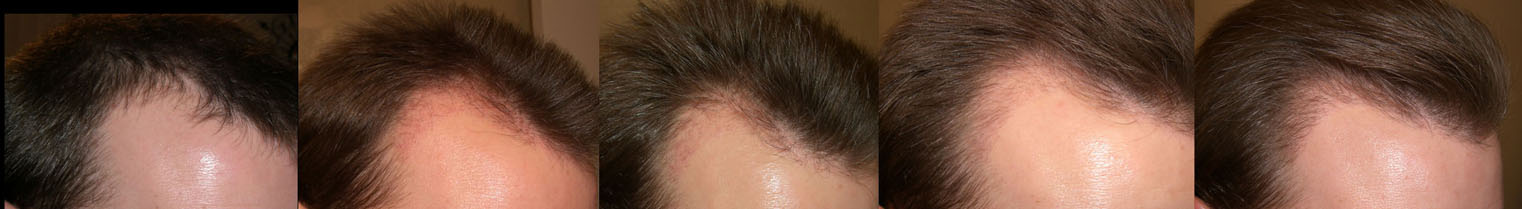 hair3-right.jpg