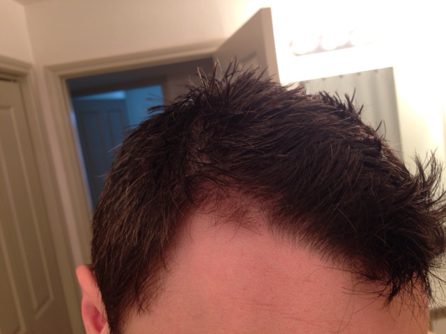 Switching from propecia to finasteride 5mg - am I ...