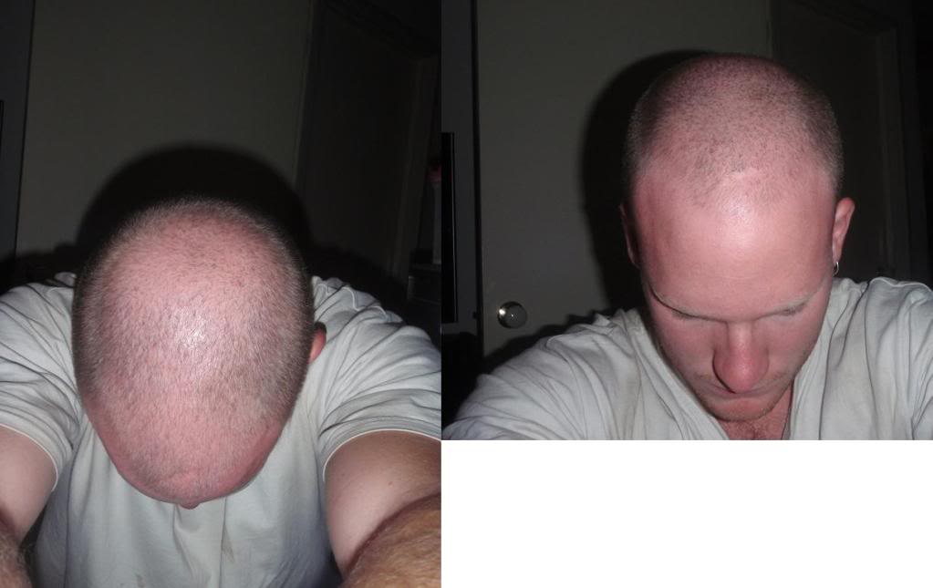 nohair.jpg