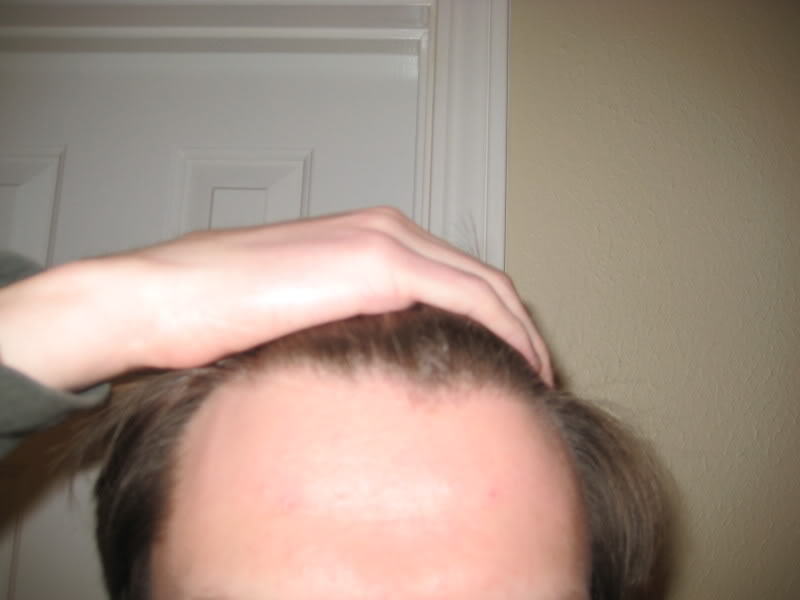 hairline6f.jpg