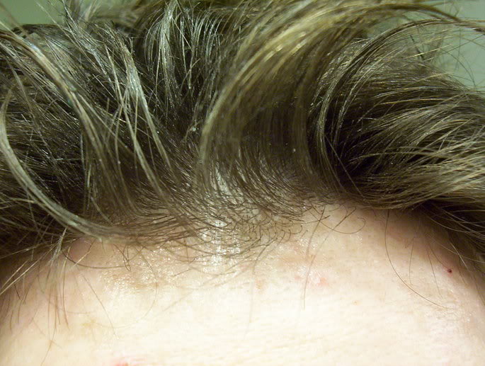 dryhairline011306001.jpg