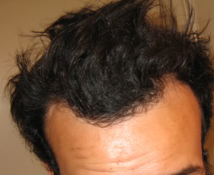 hair1.jpg