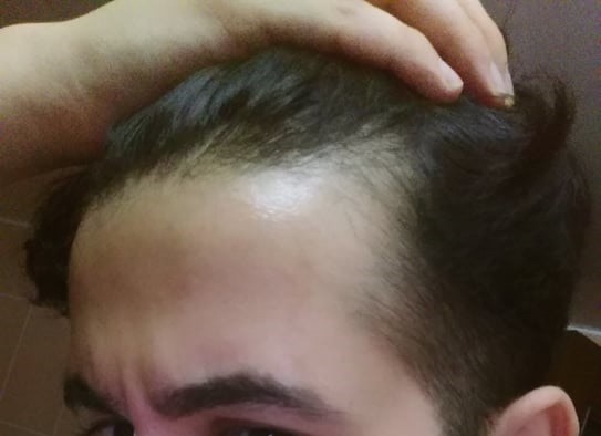 aY6rM4.jpg