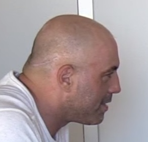 Joe%20Rogan%20scar_zpsmqrnayjm.jpg