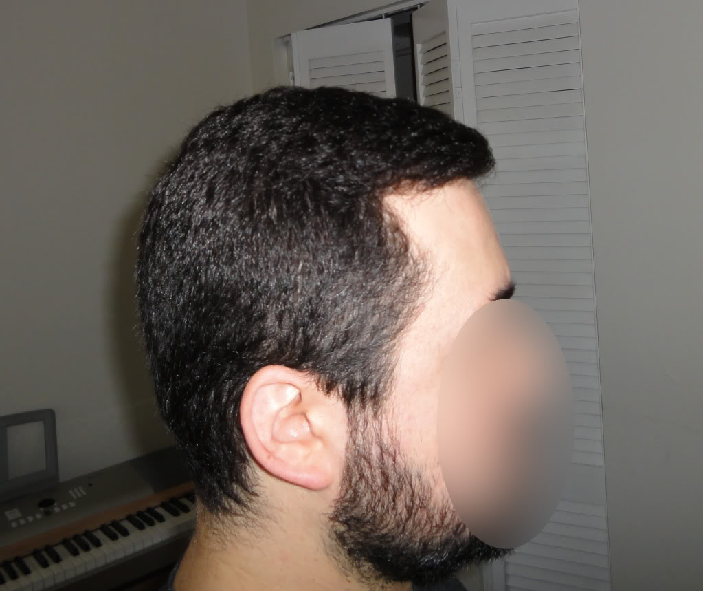 knowhair-right-side-view.jpg