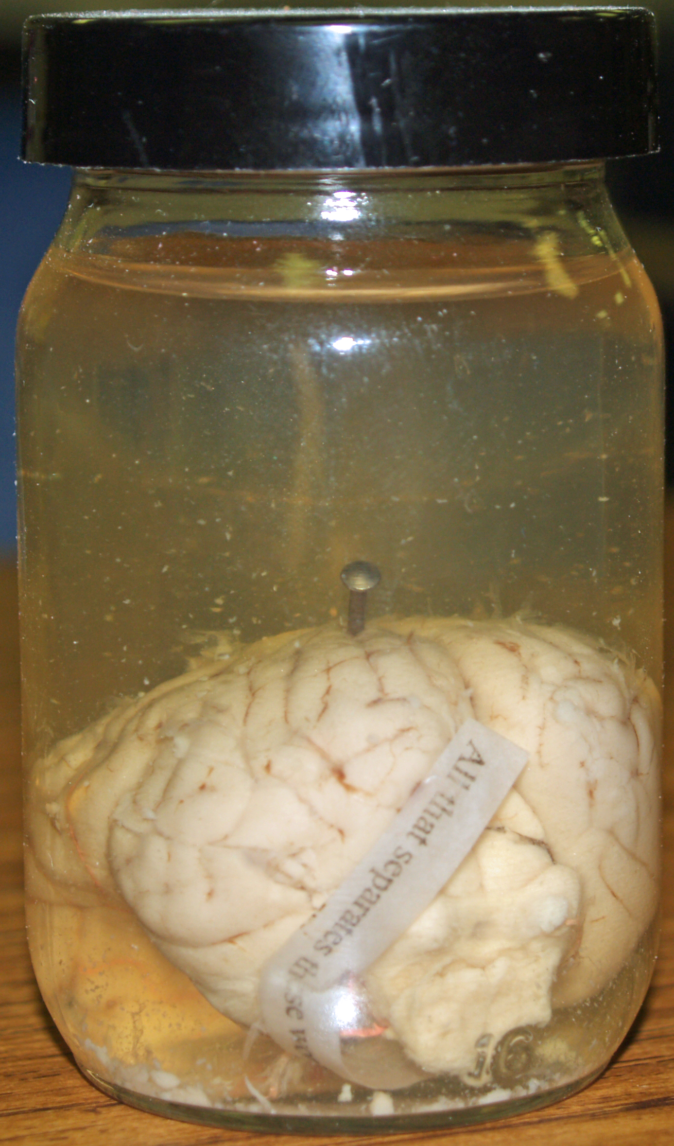 Pig_Brain_in_a_Jar.jpg