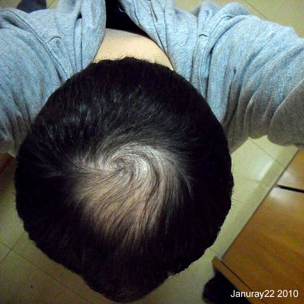 hairtopjan2010.jpg