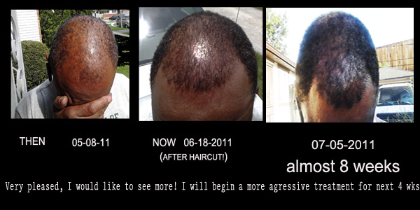 immortalhair.forumotion.com