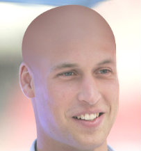 Prince-William-bald_zps5a9a469b.jpg