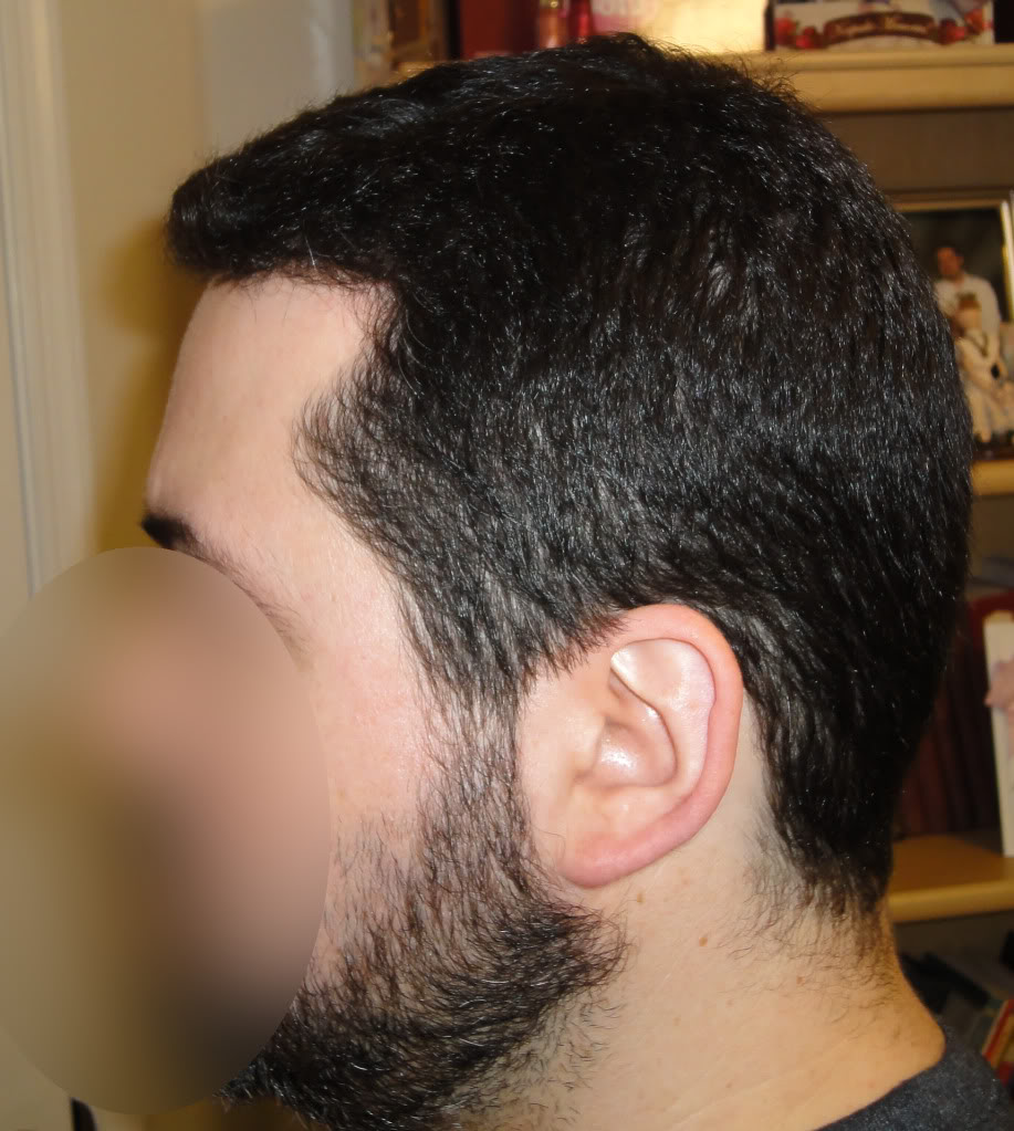 knowhair-left-side-view.jpg