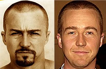 edward-norton-hair-transplant.jpg